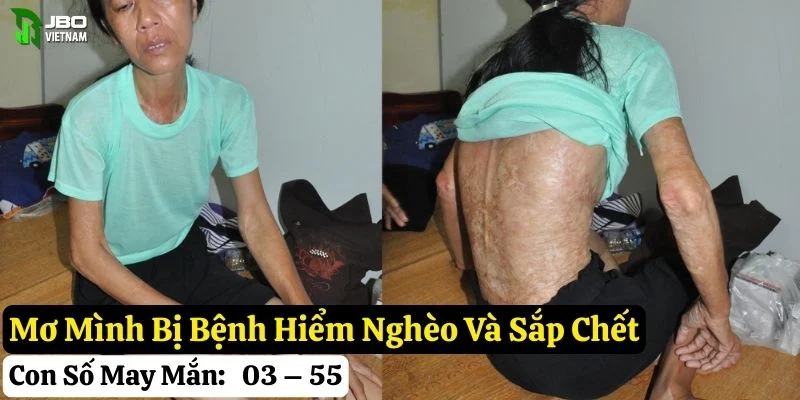 nằm mơ mình bị bệnh hiểm nghèo