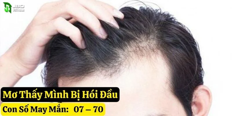 mơ thấy hói đầu jbo