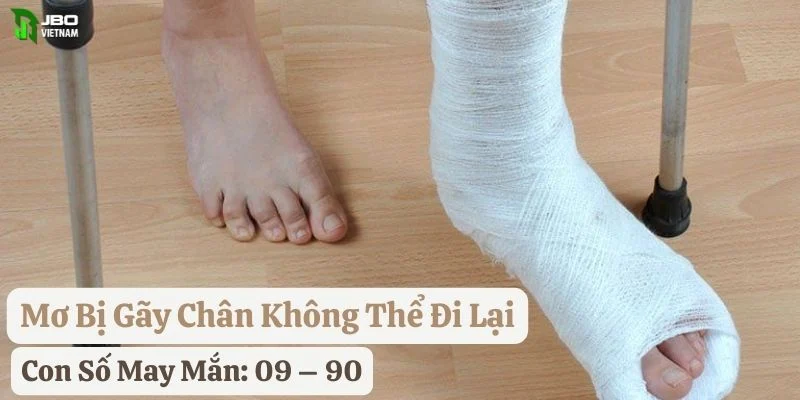 mơ bị gãy chân